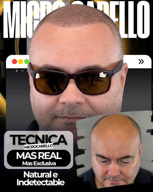 Micro Pigmentacion Capilar
